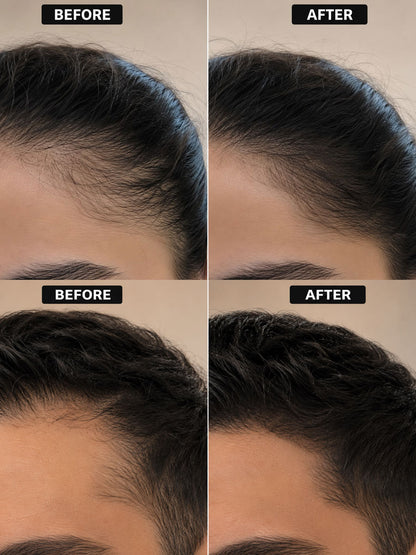 Organic Special Hair Growth Oil
